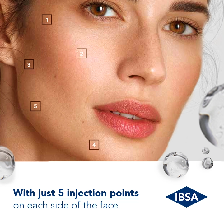 Biostimulator Profhilo